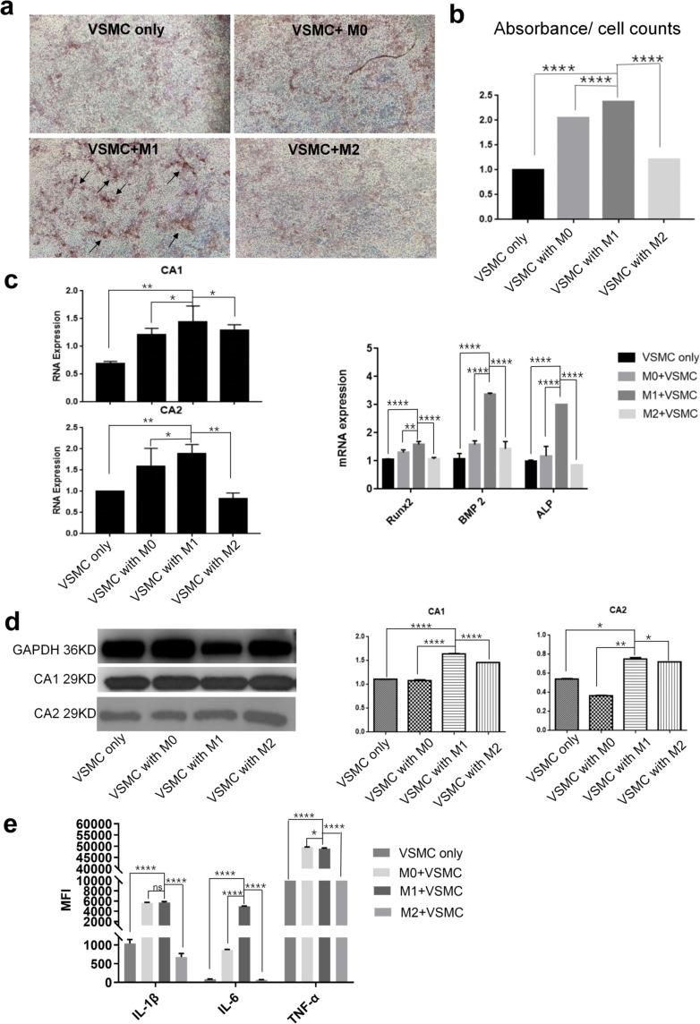https://cdn.ncbi.nlm.nih.gov/pmc/blobs/1ed0/10363393/05c262c0a781/JIR-16-3019-g0002.jpg