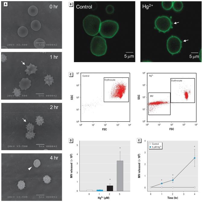 https://cdn.ncbi.nlm.nih.gov/pmc/blobs/1ed1/2920911/d6ccceed5a9e/ehp-118-928f1.jpg