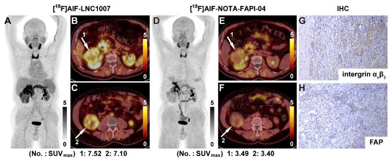 https://cdn.ncbi.nlm.nih.gov/pmc/blobs/1edc/12068302/55af5b9fe324/thnov15p5790g004.jpg