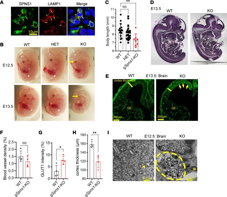 https://cdn.ncbi.nlm.nih.gov/pmc/blobs/1ee3/11141868/4eb07f641d30/jciinsight-9-175462-g102.jpg