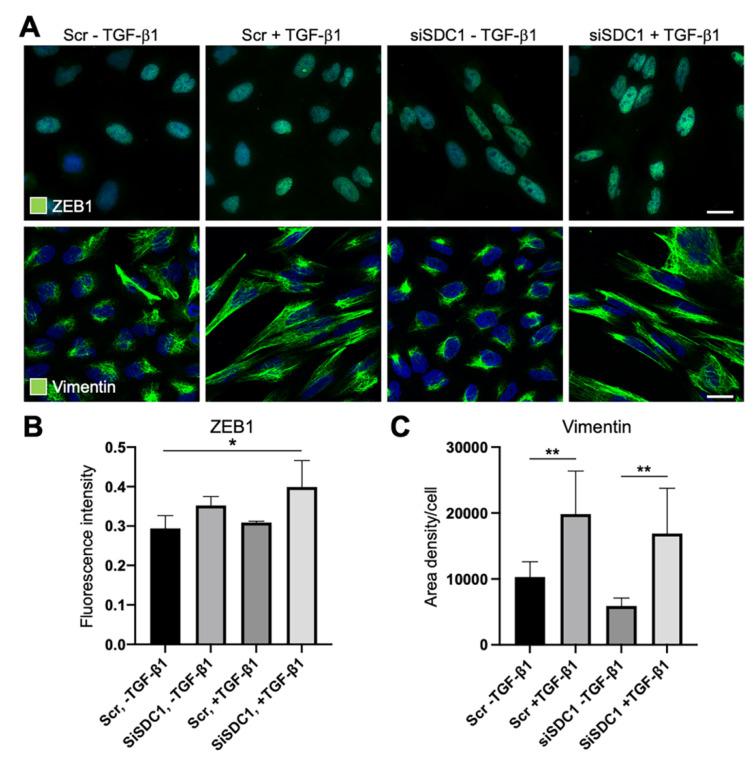 https://cdn.ncbi.nlm.nih.gov/pmc/blobs/1ee6/8230654/9e092b506bbd/biology-10-00521-g004.jpg