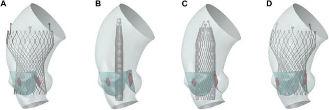 https://cdn.ncbi.nlm.nih.gov/pmc/blobs/1ef5/11187333/e435b8f354d8/fphys-15-1407215-g004.jpg