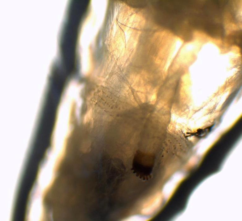https://cdn.ncbi.nlm.nih.gov/pmc/blobs/1ef5/9557823/a39535880142/mtsi-02-5369-g004.jpg