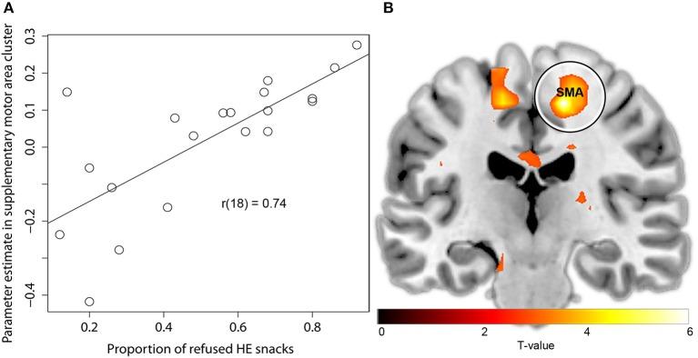 https://cdn.ncbi.nlm.nih.gov/pmc/blobs/1ef7/4179768/0f00af572a57/fnins-08-00308-g0004.jpg