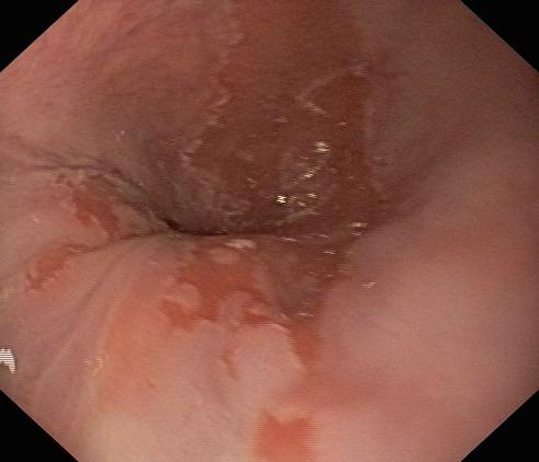 https://cdn.ncbi.nlm.nih.gov/pmc/blobs/1efc/5052494/0d81e13b077b/JMedLife-02-241-g002.jpg