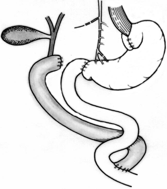 https://cdn.ncbi.nlm.nih.gov/pmc/blobs/1efc/5052494/10b476298406/JMedLife-02-241-g007.jpg