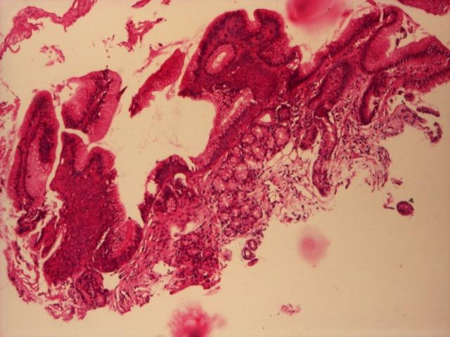 https://cdn.ncbi.nlm.nih.gov/pmc/blobs/1efc/5052494/b584529d6d36/JMedLife-02-241-g003.jpg