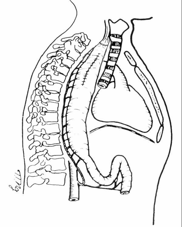 https://cdn.ncbi.nlm.nih.gov/pmc/blobs/1efc/5052494/e926f2e50697/JMedLife-02-241-g009.jpg