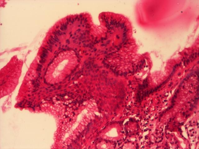 https://cdn.ncbi.nlm.nih.gov/pmc/blobs/1efc/5052494/edf960f88f58/JMedLife-02-241-g004.jpg