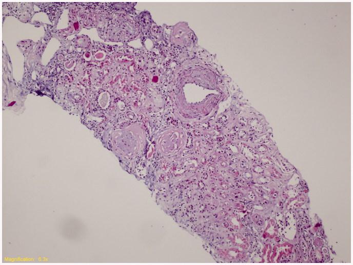 https://cdn.ncbi.nlm.nih.gov/pmc/blobs/1f06/6014365/17cbbd6de862/IRNF_A_1254656_F0001_C.jpg