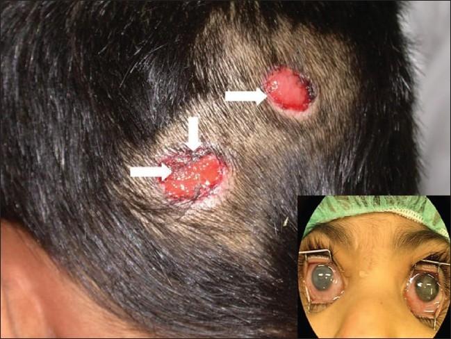https://cdn.ncbi.nlm.nih.gov/pmc/blobs/1f12/2813592/00aefa7a8f5c/MEAJO-16-92-g003.jpg