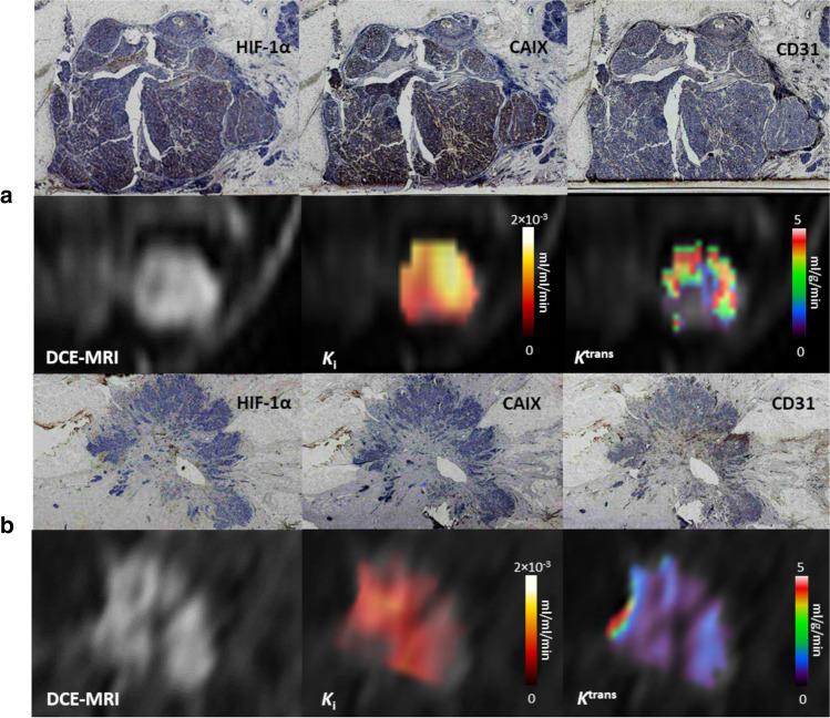 https://cdn.ncbi.nlm.nih.gov/pmc/blobs/1f18/10415421/3e5d34482834/330_2023_9572_Fig2_HTML.jpg
