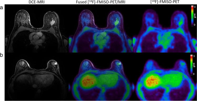 https://cdn.ncbi.nlm.nih.gov/pmc/blobs/1f18/10415421/f339884d0f49/330_2023_9572_Fig3_HTML.jpg
