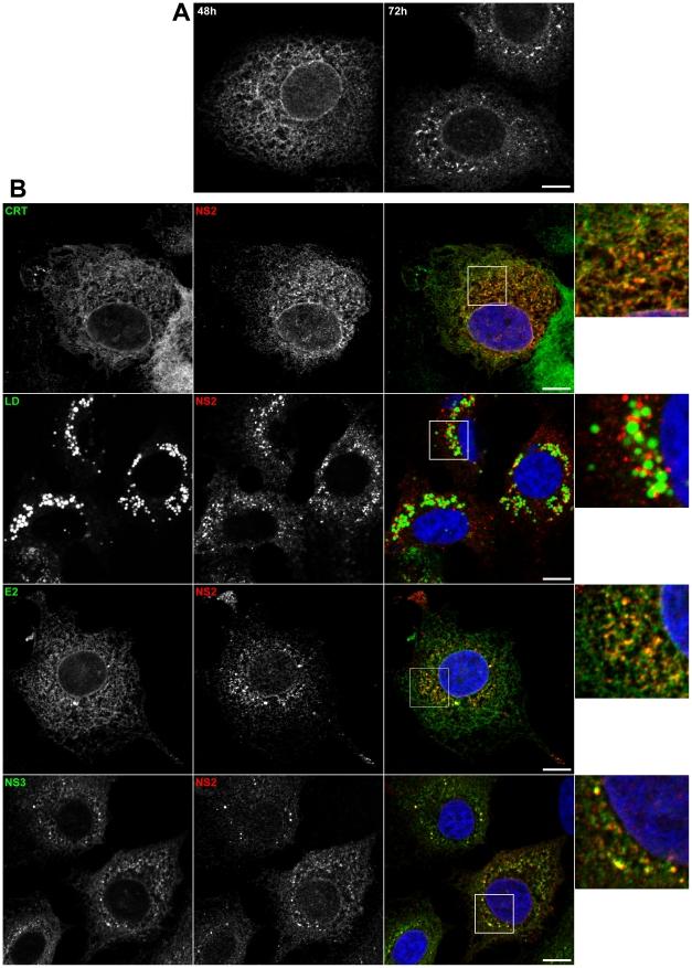 https://cdn.ncbi.nlm.nih.gov/pmc/blobs/1f18/3037360/ee39ae4362f9/ppat.1001278.g003.jpg