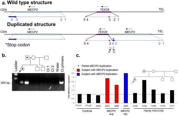 https://cdn.ncbi.nlm.nih.gov/pmc/blobs/1f1c/3575261/6c8a290f3a32/1471-2350-13-71-3.jpg