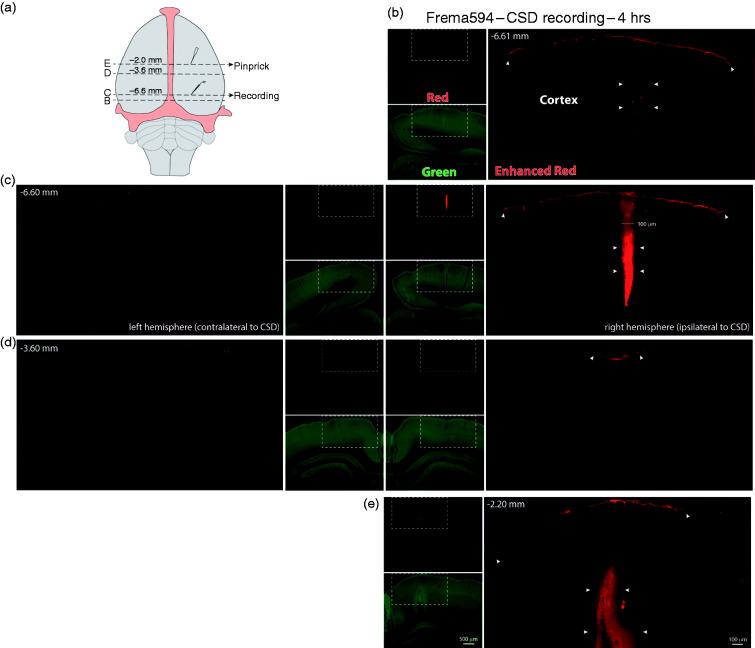 https://cdn.ncbi.nlm.nih.gov/pmc/blobs/1f1c/7385853/72e71becd860/10.1177_0333102419896760-fig5.jpg