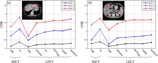 https://cdn.ncbi.nlm.nih.gov/pmc/blobs/1f27/5655040/68583964d9c4/41598_2017_13520_Fig14_HTML.jpg