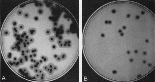 https://cdn.ncbi.nlm.nih.gov/pmc/blobs/1f2a/377211/abc76bf6292f/applmicro00113-0118-a.jpg