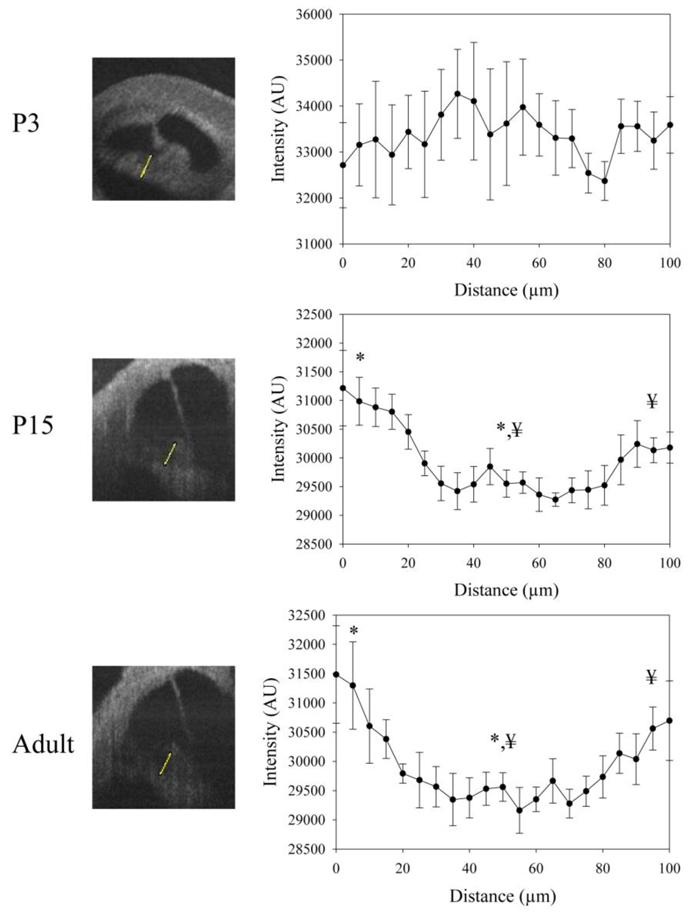 https://cdn.ncbi.nlm.nih.gov/pmc/blobs/1f35/3482885/ed413a8223db/oe-19-16-15415-g008.jpg
