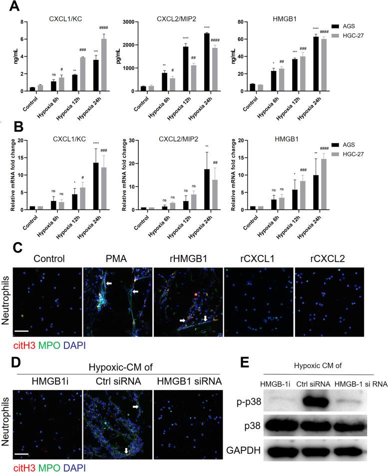 https://cdn.ncbi.nlm.nih.gov/pmc/blobs/1f3f/10152773/8f00a60508f5/12964_2023_1112_Fig4_HTML.jpg