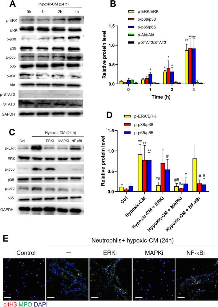https://cdn.ncbi.nlm.nih.gov/pmc/blobs/1f3f/10152773/e5d57c73dc56/12964_2023_1112_Fig3_HTML.jpg