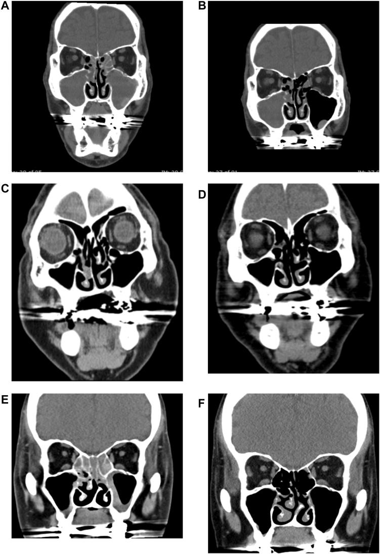 https://cdn.ncbi.nlm.nih.gov/pmc/blobs/1f4c/11986613/eb0d3255ccbd/gr2.jpg