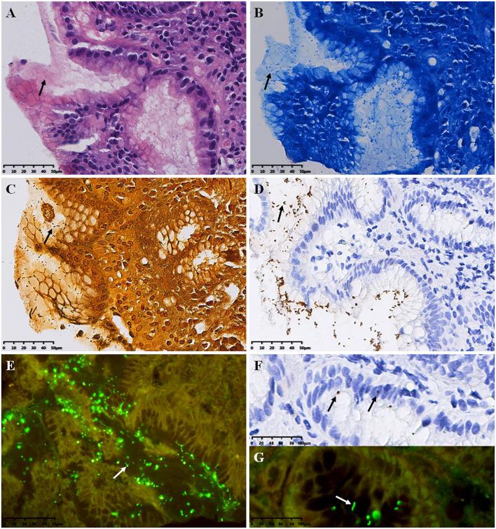 https://cdn.ncbi.nlm.nih.gov/pmc/blobs/1f4d/10393117/f12ac8163d04/fonc-13-1229871-g001.jpg