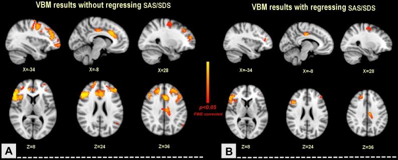 https://cdn.ncbi.nlm.nih.gov/pmc/blobs/1f4f/3699561/c75f12977713/pone.0068383.g001.jpg