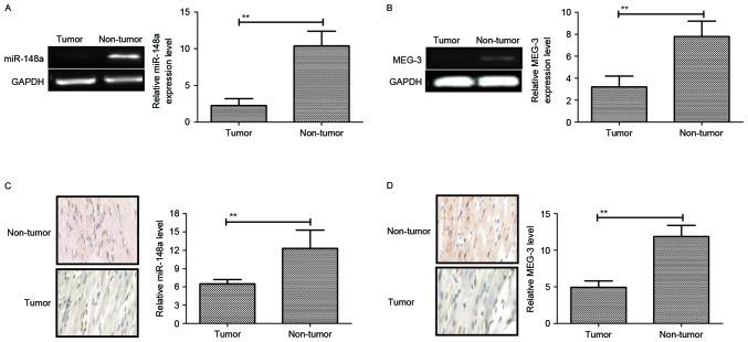 https://cdn.ncbi.nlm.nih.gov/pmc/blobs/1f62/6307449/4bb46b4d047c/etm-17-01-0639-g00.jpg