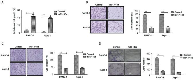 https://cdn.ncbi.nlm.nih.gov/pmc/blobs/1f62/6307449/d3e6c30e8aeb/etm-17-01-0639-g02.jpg