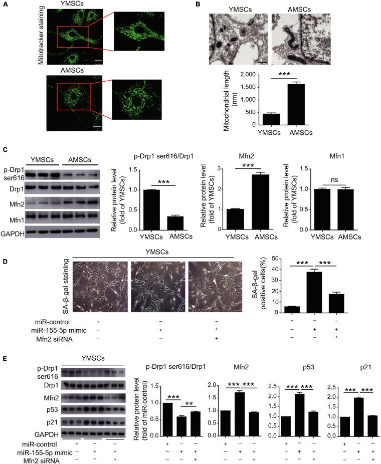 https://cdn.ncbi.nlm.nih.gov/pmc/blobs/1f63/8017203/8c30c093fb2d/fcell-09-650431-g003.jpg