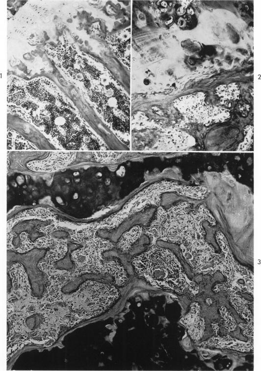https://cdn.ncbi.nlm.nih.gov/pmc/blobs/1f6c/1942402/2e80509334e6/amjpathol00335-0090-a.jpg
