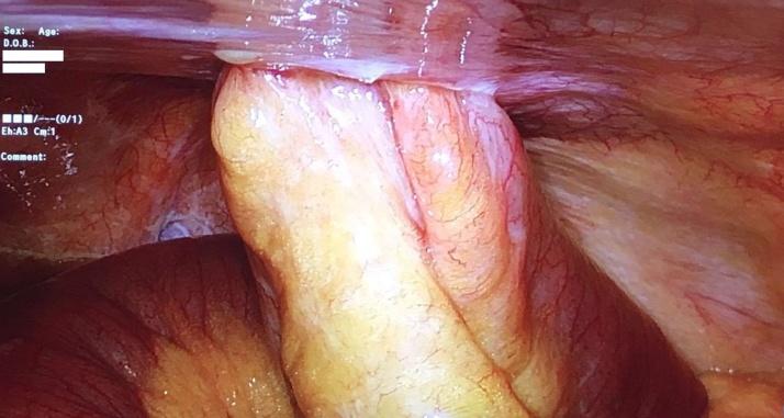https://cdn.ncbi.nlm.nih.gov/pmc/blobs/1f6c/6290395/4b1308aae2e6/gr3.jpg