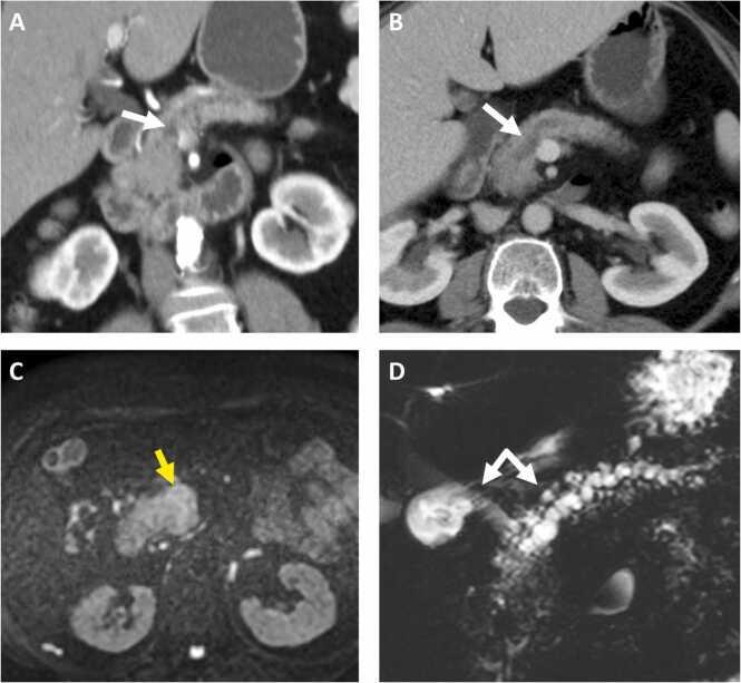 https://cdn.ncbi.nlm.nih.gov/pmc/blobs/1f6f/10864763/d08a9867901a/gr3.jpg