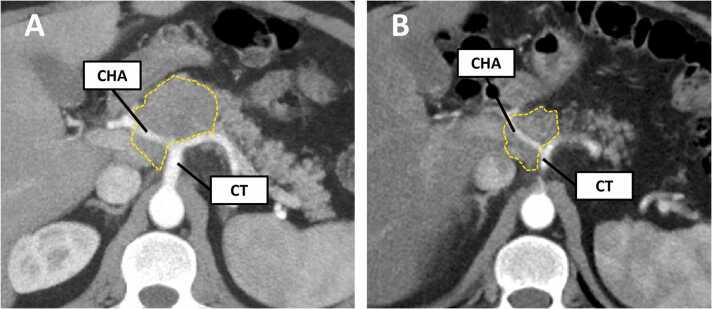 https://cdn.ncbi.nlm.nih.gov/pmc/blobs/1f6f/10864763/d0ed8b14ec6f/gr12.jpg