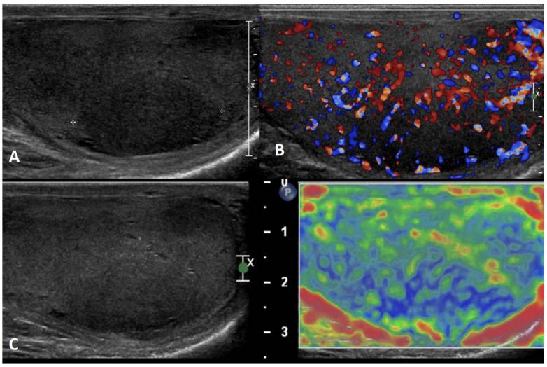 https://cdn.ncbi.nlm.nih.gov/pmc/blobs/1f75/10670367/87d17cc35610/cancers-15-05332-g017.jpg