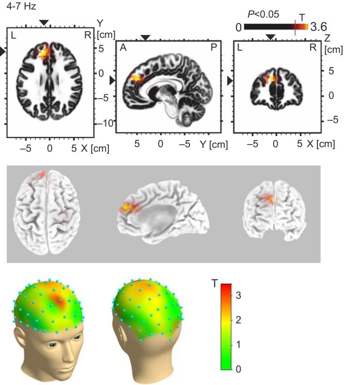 https://cdn.ncbi.nlm.nih.gov/pmc/blobs/1f7a/5763419/6419adf78f02/EJP-22-49-g001.jpg
