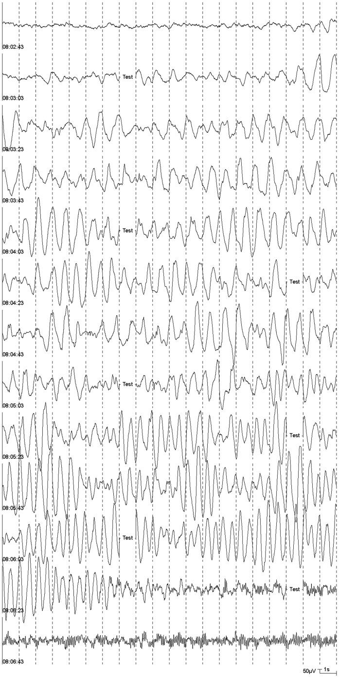 https://cdn.ncbi.nlm.nih.gov/pmc/blobs/1f7c/3400655/f922321ee858/pone.0040903.g003.jpg