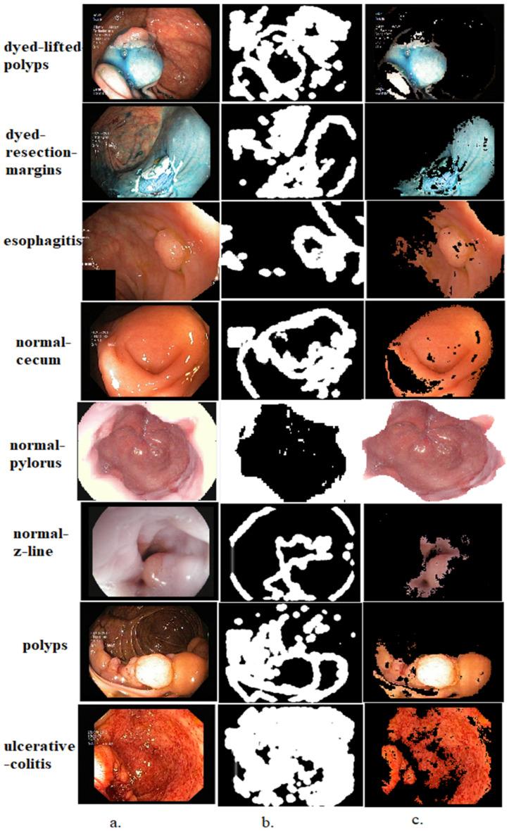 https://cdn.ncbi.nlm.nih.gov/pmc/blobs/1f83/10217222/836c3f2793e5/diagnostics-13-01758-g002.jpg