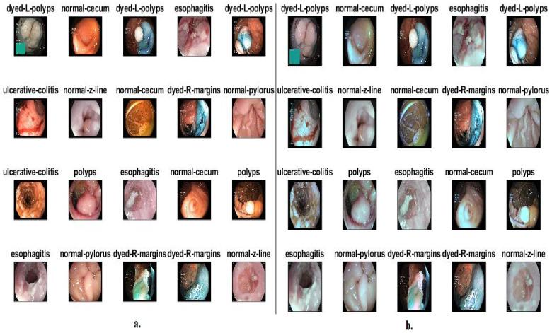 https://cdn.ncbi.nlm.nih.gov/pmc/blobs/1f83/10217222/ef3302dcb0e2/diagnostics-13-01758-g001.jpg