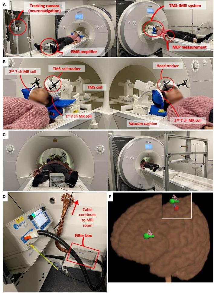 https://cdn.ncbi.nlm.nih.gov/pmc/blobs/1f86/9069063/397ba971be01/fpsyt-13-825205-g0001.jpg
