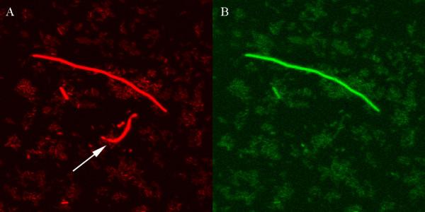 https://cdn.ncbi.nlm.nih.gov/pmc/blobs/1f89/2994835/48cd39290252/1471-2180-10-283-4.jpg