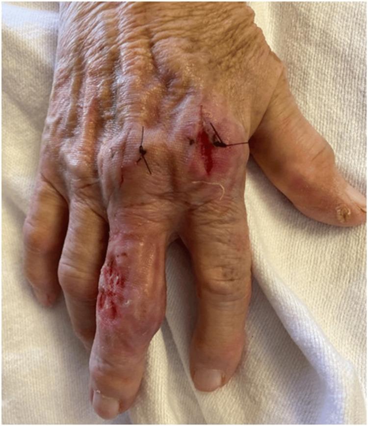 https://cdn.ncbi.nlm.nih.gov/pmc/blobs/1f8f/10989203/0900edcf670e/cureus-0016-00000057514-i02.jpg