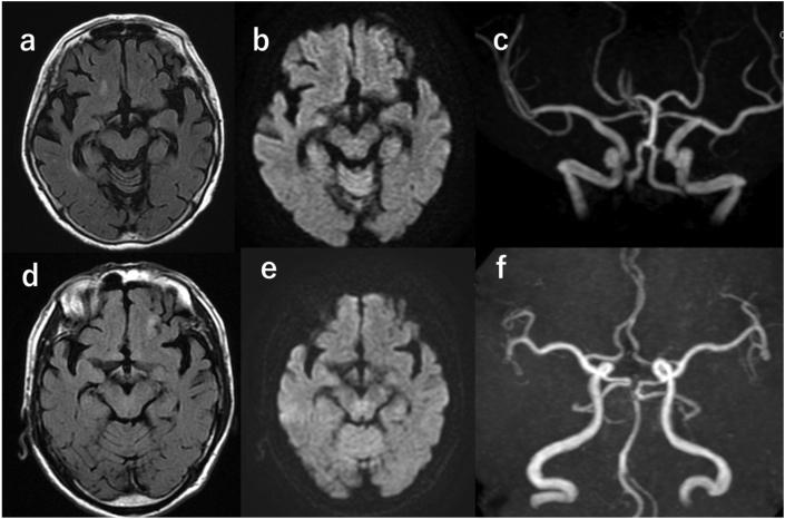 https://cdn.ncbi.nlm.nih.gov/pmc/blobs/1f96/7718458/9d073c7650a3/gr1.jpg
