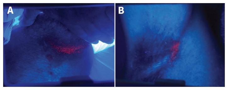 https://cdn.ncbi.nlm.nih.gov/pmc/blobs/1f9a/8568083/a62ccb0803a4/193e1535f2.jpg