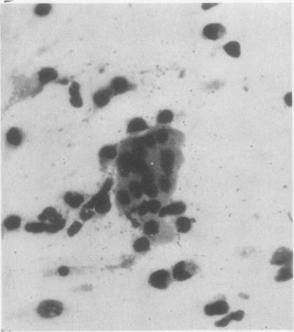 https://cdn.ncbi.nlm.nih.gov/pmc/blobs/1fa6/479927/21424eb4015e/jclinpath00051-0048-c.jpg