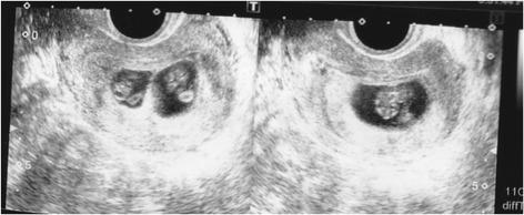 https://cdn.ncbi.nlm.nih.gov/pmc/blobs/1faa/5627466/d49b5187e479/12958_2017_302_Fig1_HTML.jpg