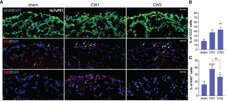 https://cdn.ncbi.nlm.nih.gov/pmc/blobs/1fac/11176452/03186d33c804/fonc-14-1307516-g008.jpg