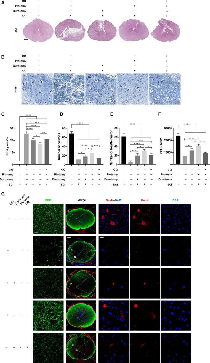 https://cdn.ncbi.nlm.nih.gov/pmc/blobs/1faf/7686991/6069ab358cdc/JCMM-24-12765-g005.jpg