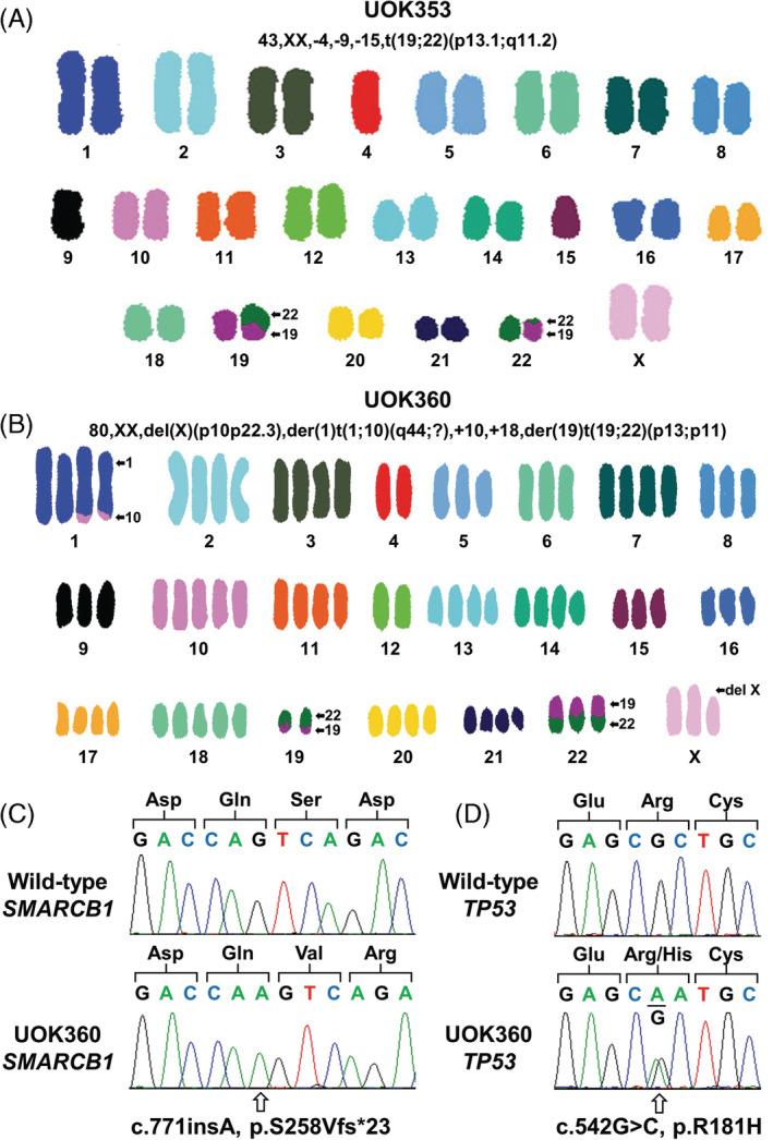 https://cdn.ncbi.nlm.nih.gov/pmc/blobs/1fb0/7383978/2a1c020788bb/GCC-59-472-g002.jpg